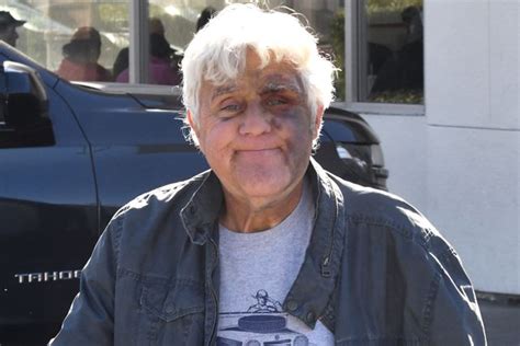hire jay leno speaker|jay leno accident.